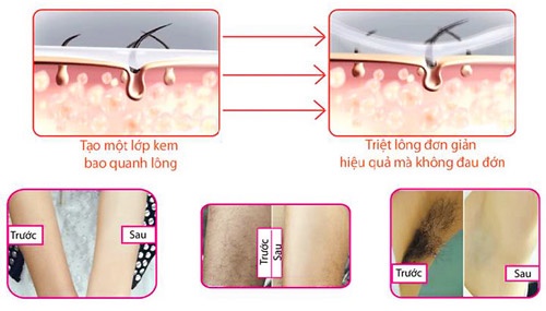 Wax lông Horshion dưỡng da, diệt khuẩn, đồng thời giúp da trắng và mềm mại