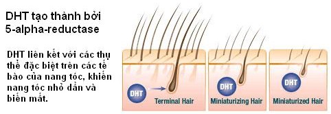 Tại sao lại chọn Viên uống hỗ trợ mọc tóc Maxxhair?