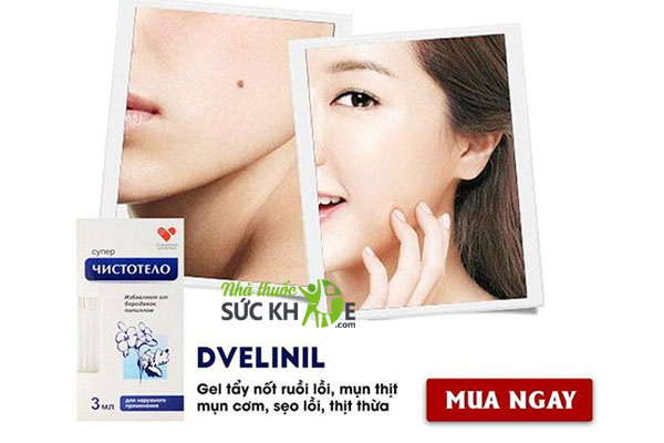 Gel tẩy nốt ruồi Dvelinil sử dụng trong những trường hợp nào?