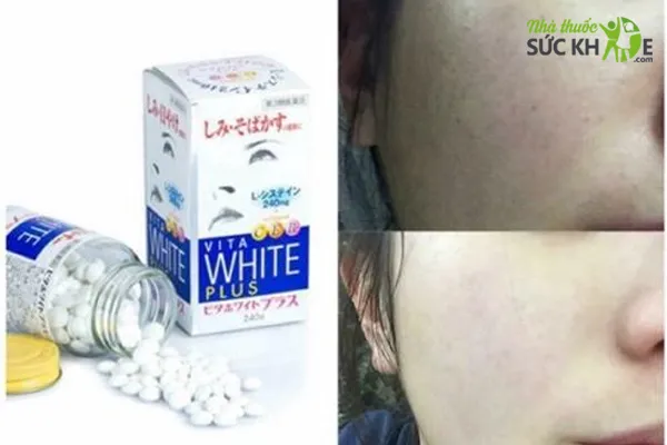 Viên uống trắng da cho nam của Nhật Vita White Plus