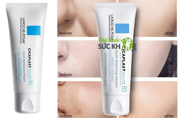 Kem dưỡng phục hồi da sau peel La Roche- Posay Cicaplast Baume B5